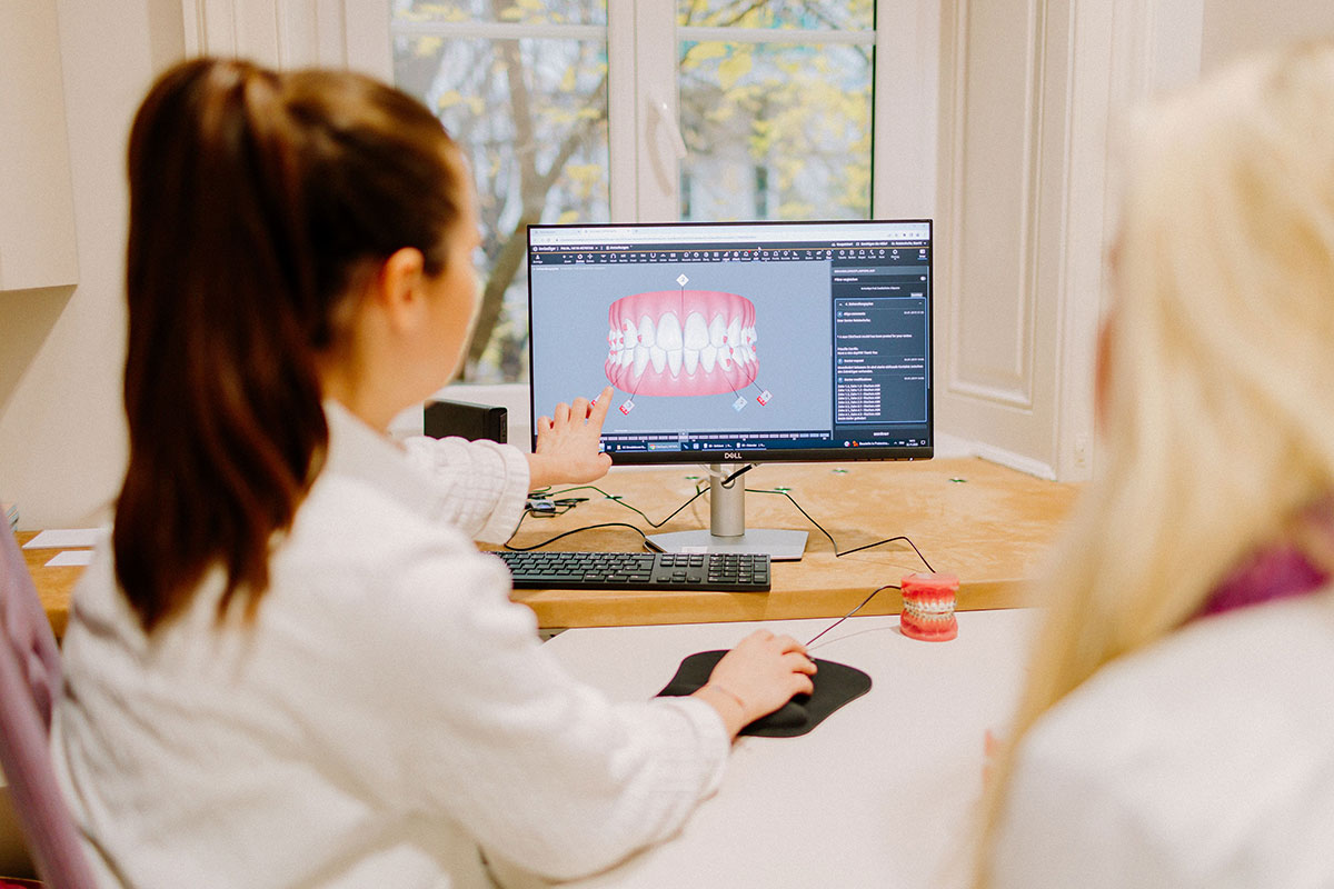 3D-Scan mit dem iTero Scanner für die unsichtbare Zahnspange in Wien